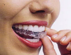 Woman with Invisalign braces